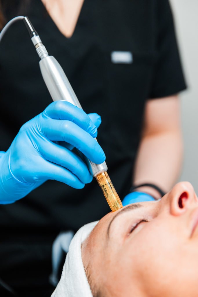 Microneedling