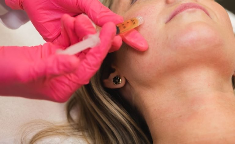 PRP-Facial