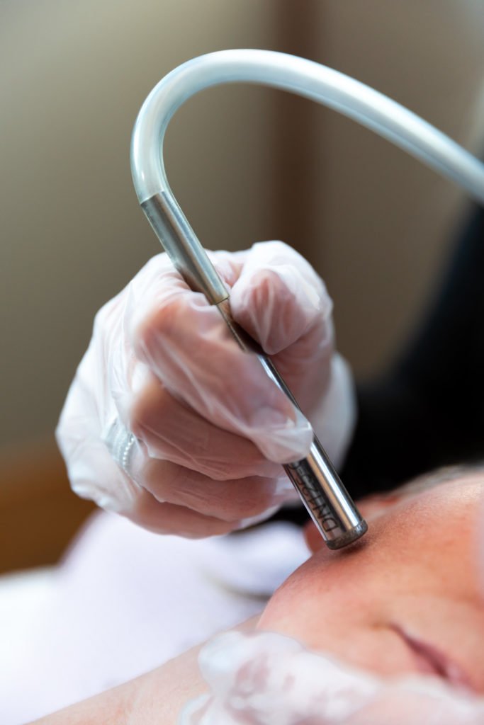 Microdermabrasion